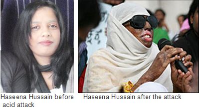 Haseena-Hussain-acid-attack