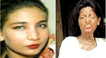 pakistan-acid-attack-victim-fakhra-yunus