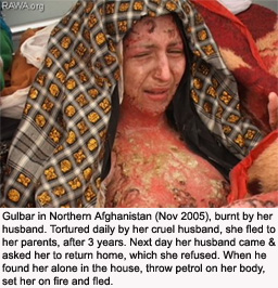 afghanistan-gulbar-burned-by-husband